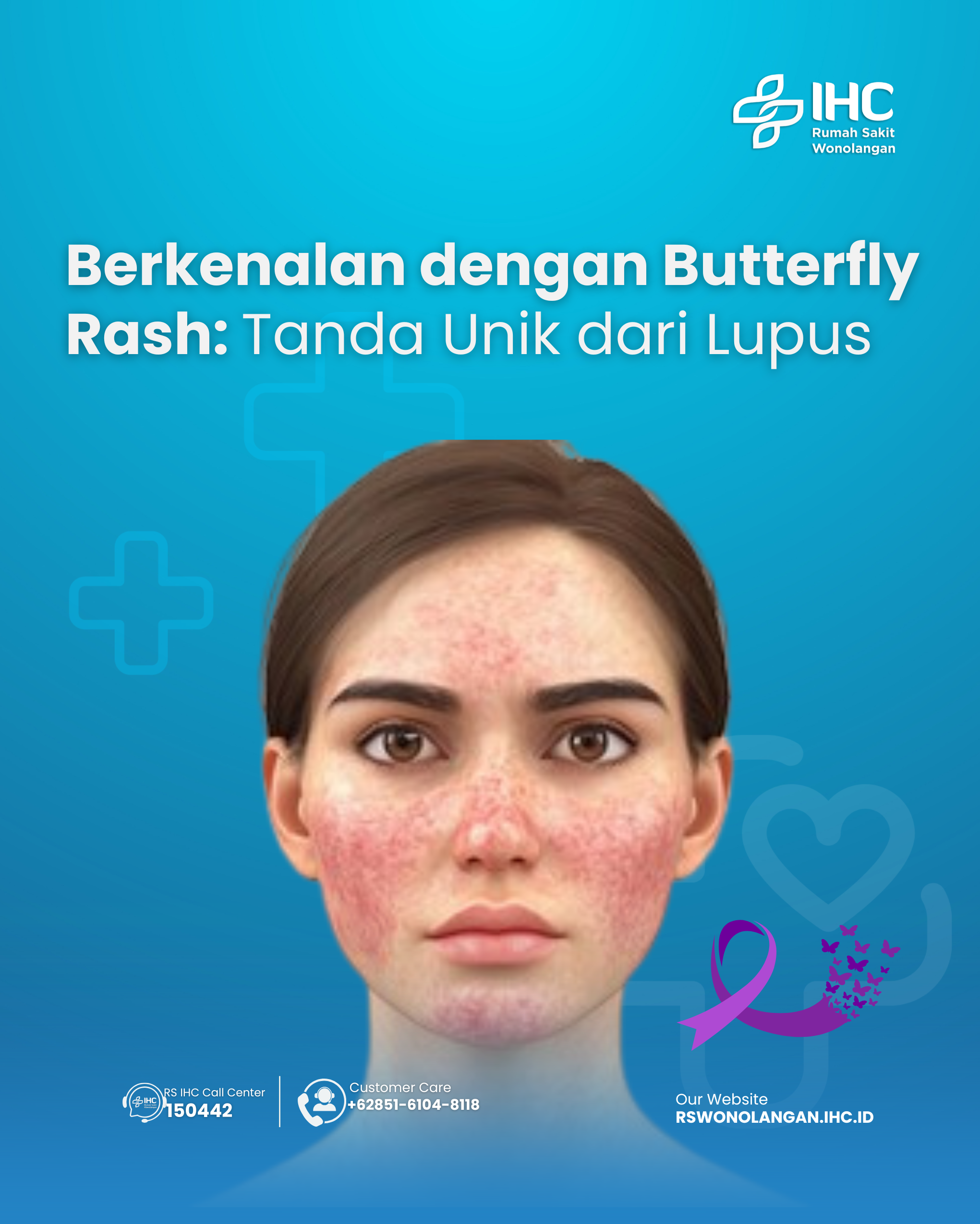Berkenalan dengan Butterfly Rash: Tanda Unik dari Lupus